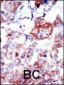 ILK1/ILK2 Antibody (N-term)